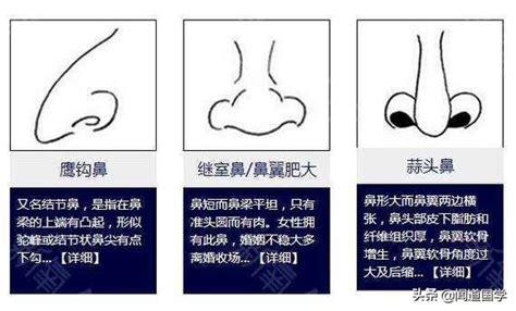 通天鼻面相|鼻子相学图解，面相学各种鼻子男女命相图